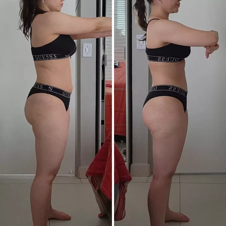 antes-e-depois-ballet-hiit-1