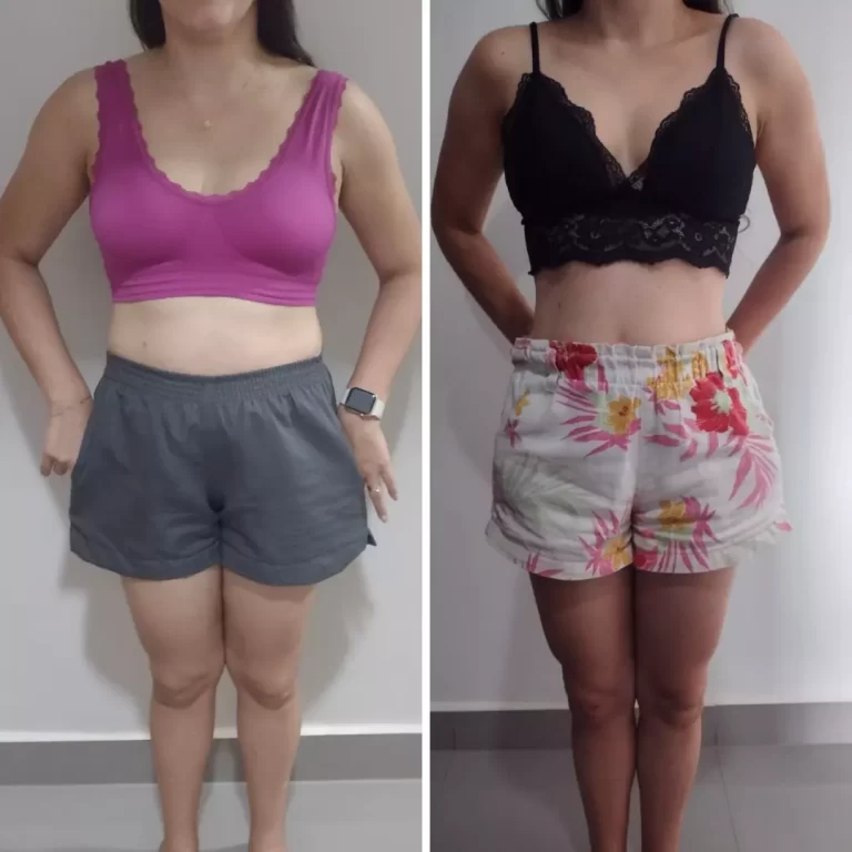 antes-e-depois-ballet-hiit