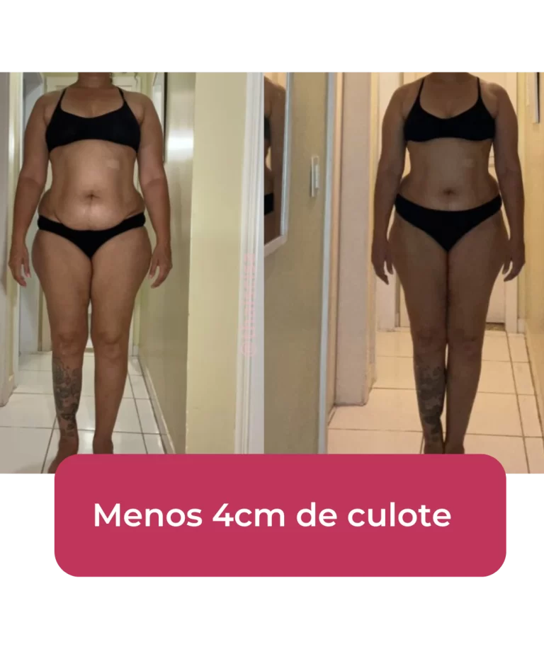 Antes-e-depois-BH-PV-_3_