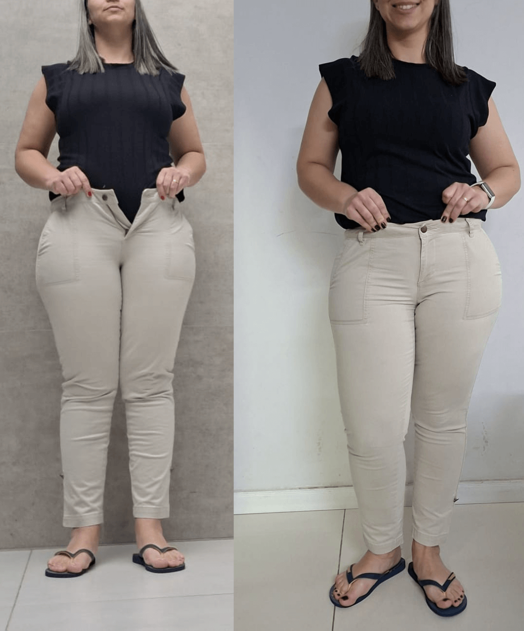 Antes-e-depois-BH-PV-_30_-_1_