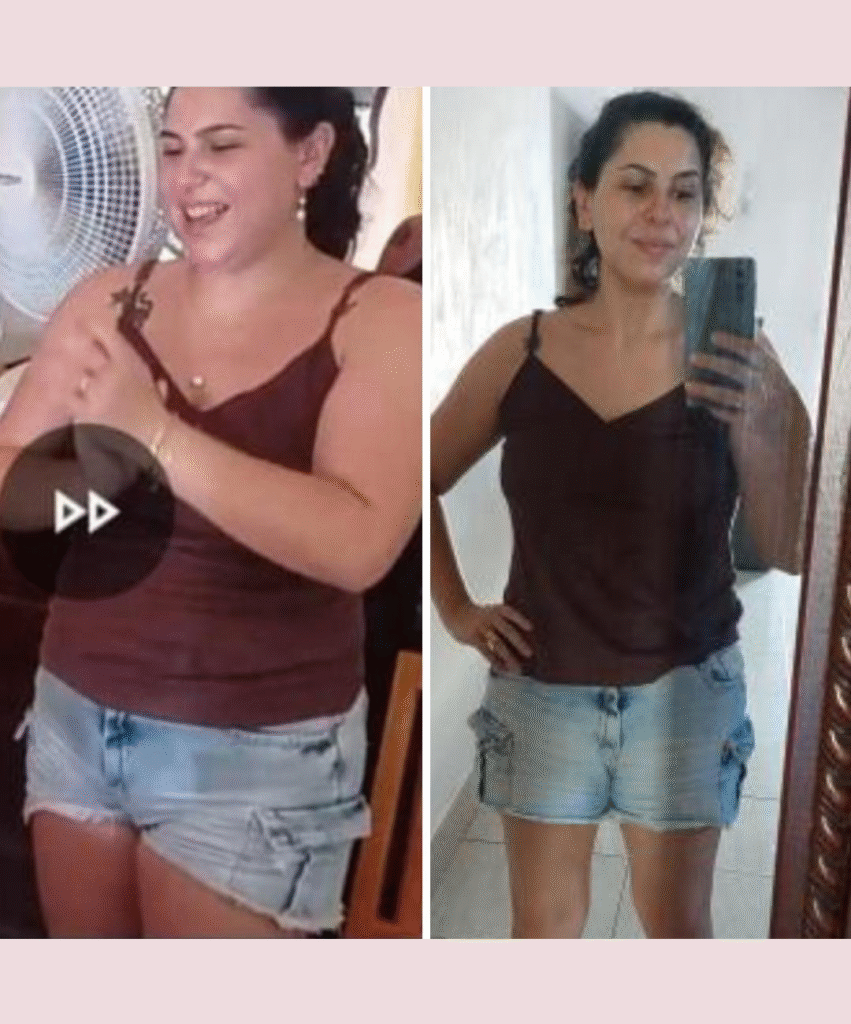 Antes e depois BH PV (42)