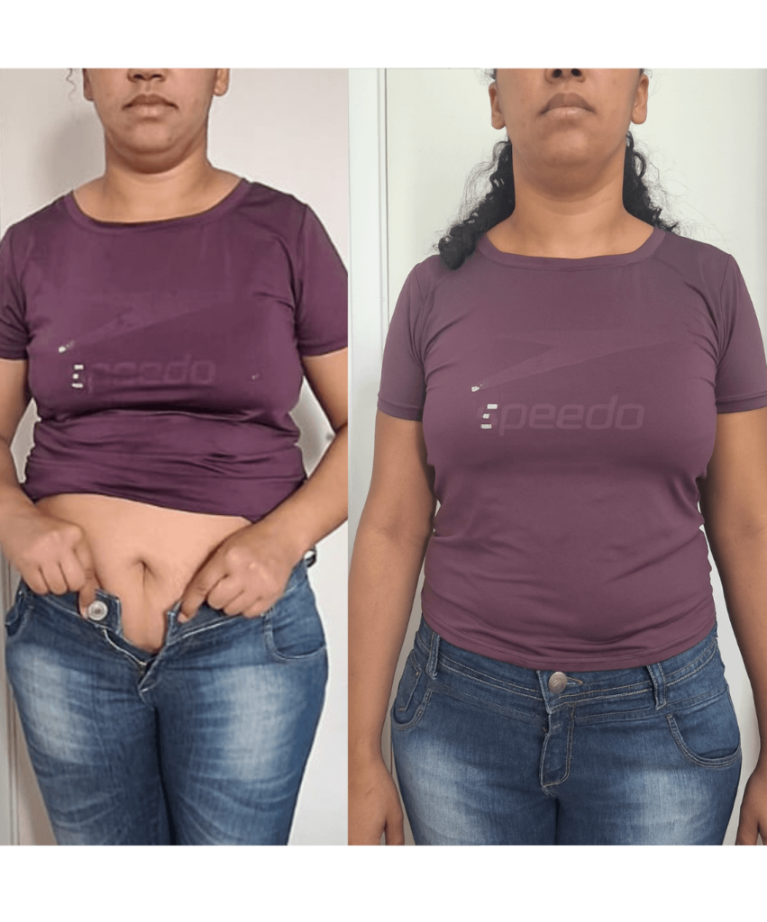Antes-e-depois-BH-PV-_29_-_1_