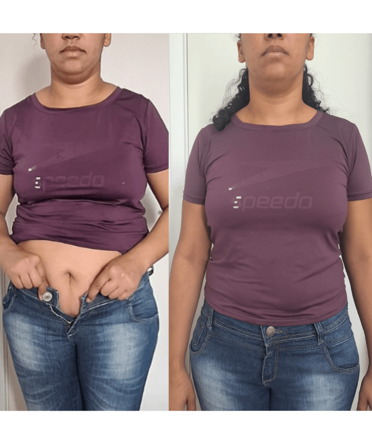 Antes-e-depois-BH-PV-_29_-_1_