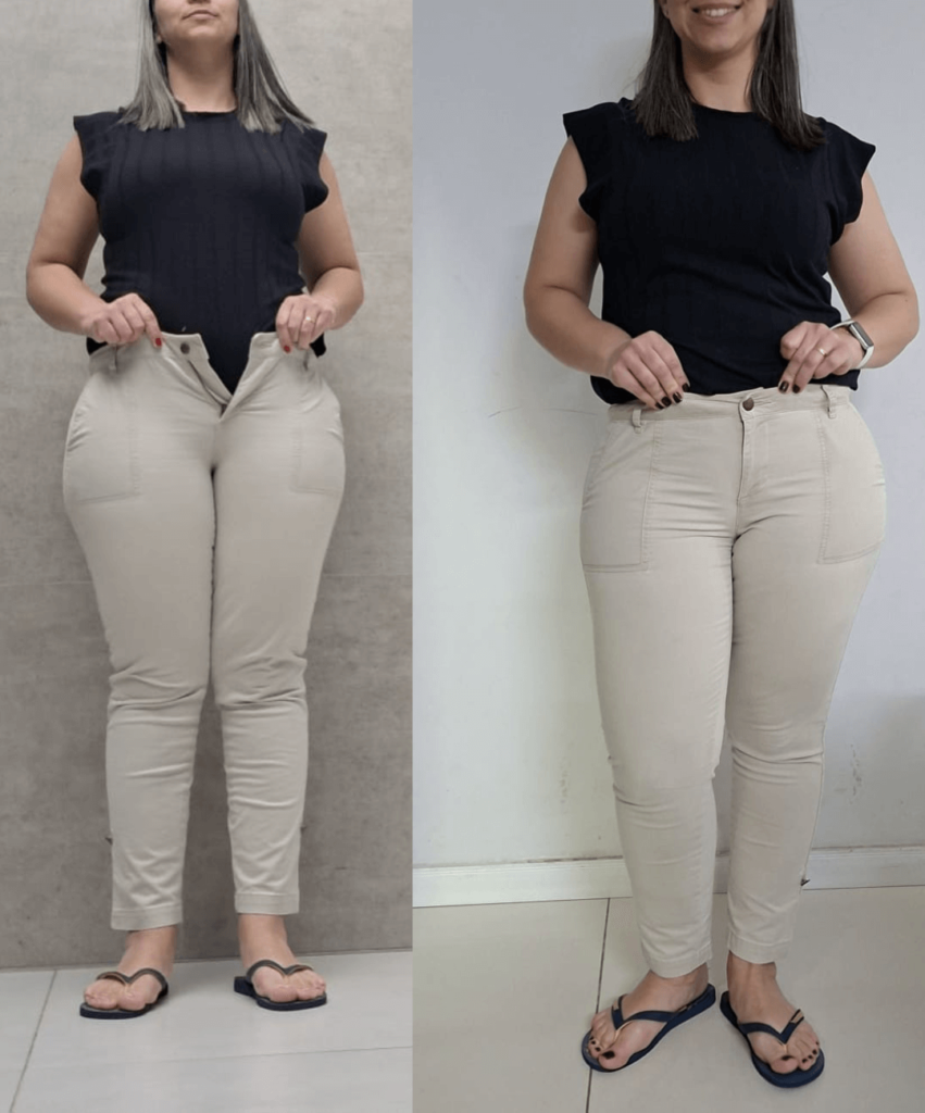 Antes-e-depois-BH-PV-_30_-_1_
