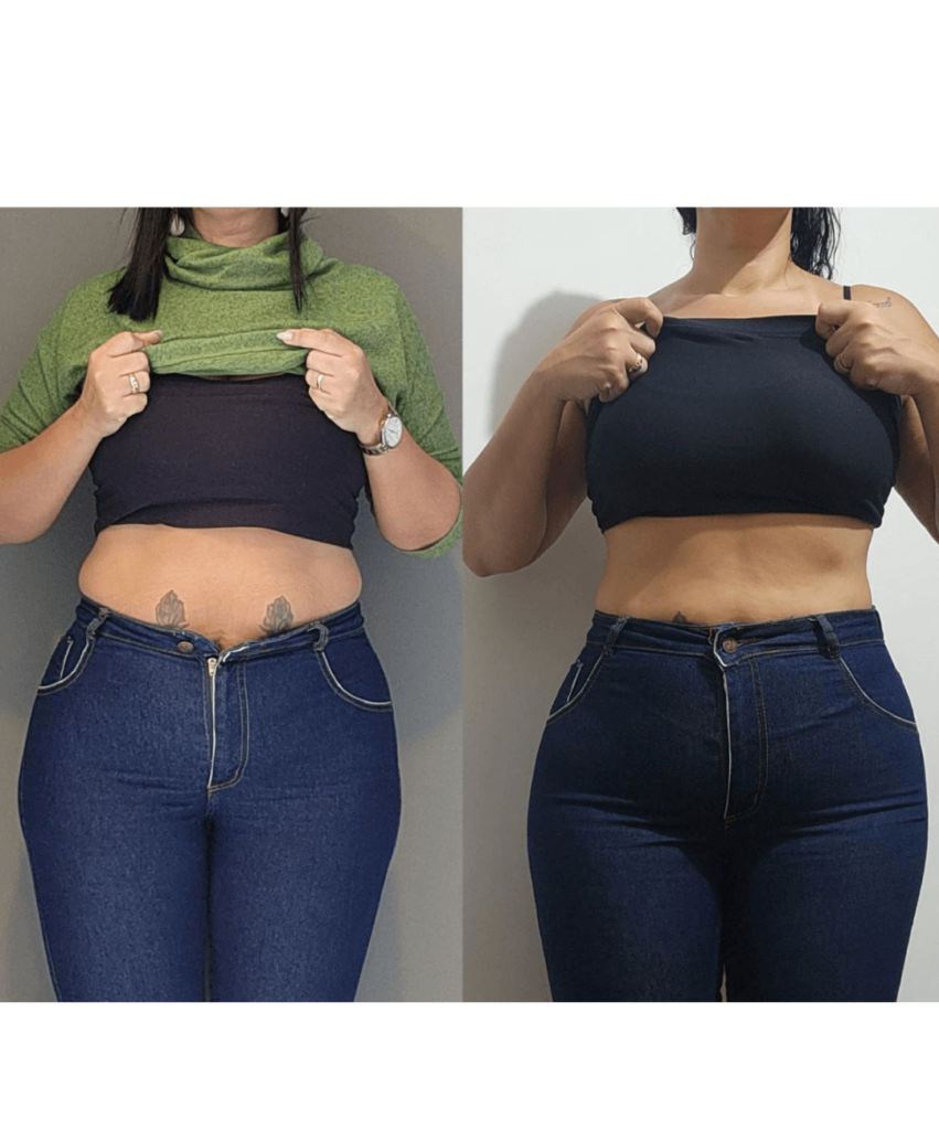 Antes-e-depois-BH-PV-_12_-_1_