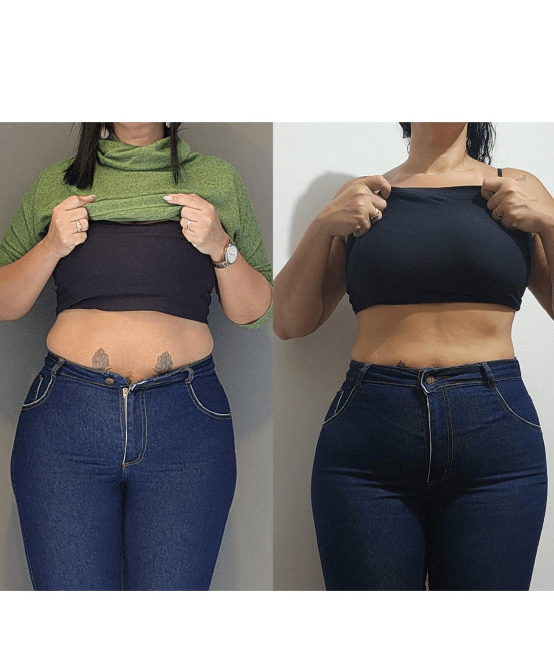 Antes-e-depois-BH-PV-_12_-_1_