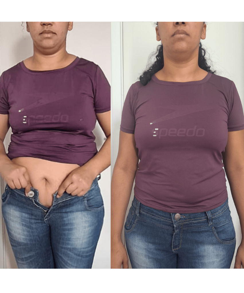 Antes-e-depois-BH-PV-_13_-_1_