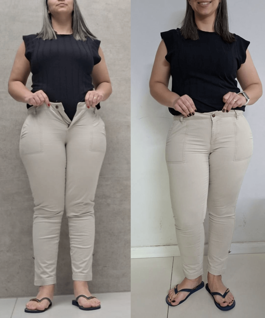 Antes-e-depois-BH-PV-_14_-_1_